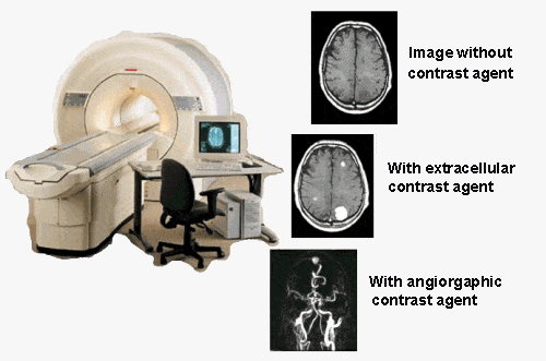 MRI_E